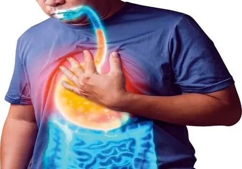 چه زمانی علائم رفلاکس در نوزادان خطرناک است؟