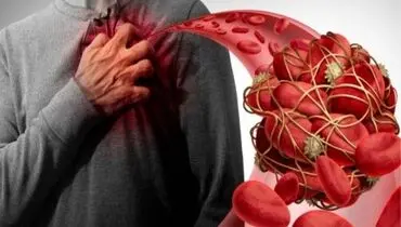 لخته شدن خون چه کسانی را تهدید می کند؟