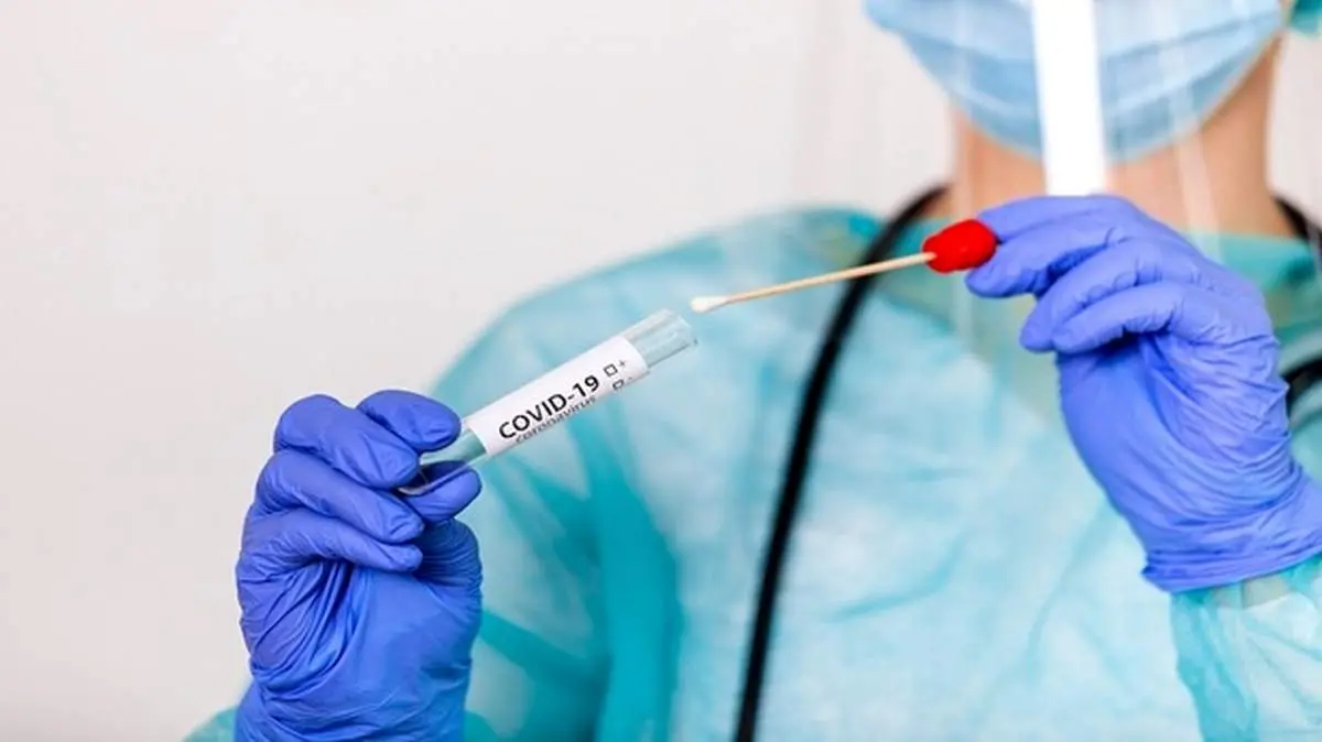 نرخ تست PCR در بخش خصوصی ۳۱۰هزار تومان