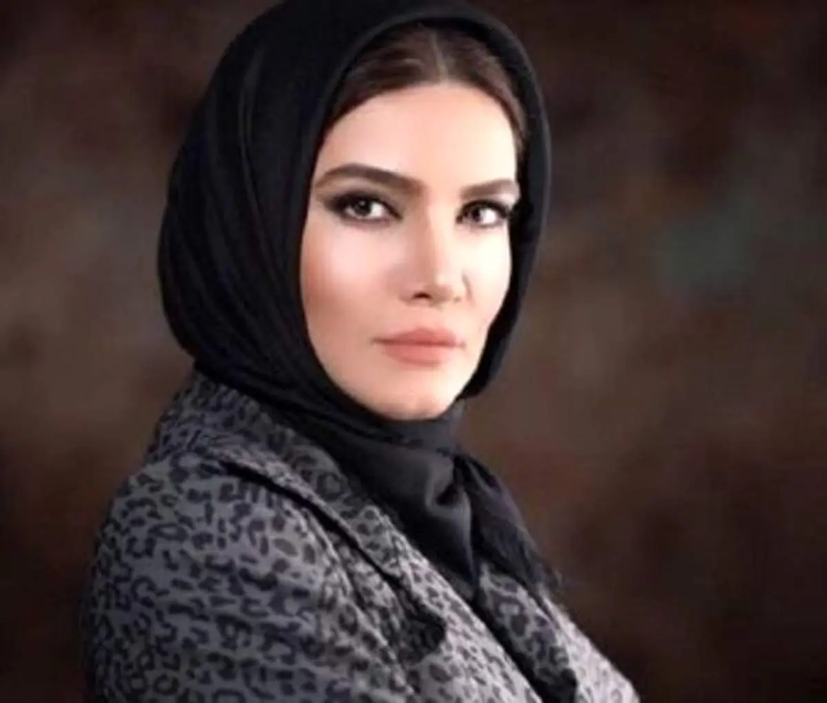 تغییر چهره بازیگر فوق لیسانسه‌ها +عکس