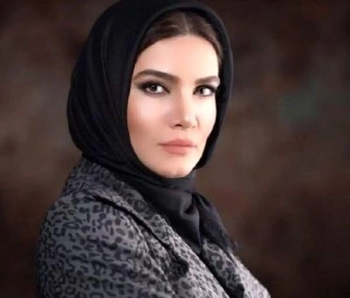 تغییر چهره بازیگر فوق لیسانسه‌ها +عکس