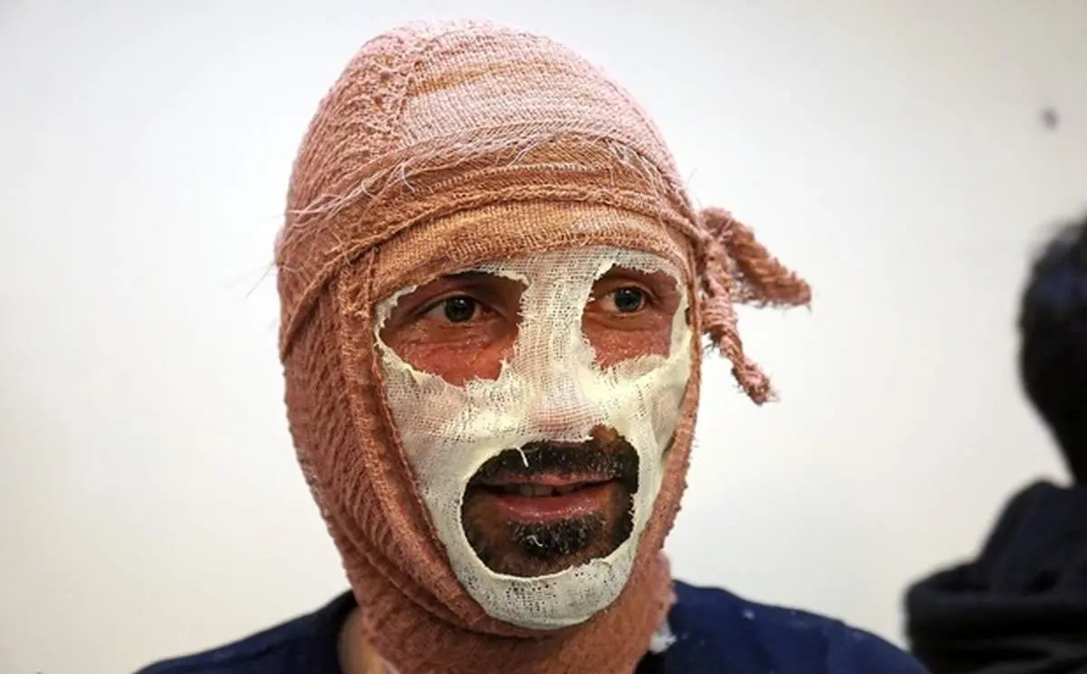 مصدومان چهارشنبه آخر سال