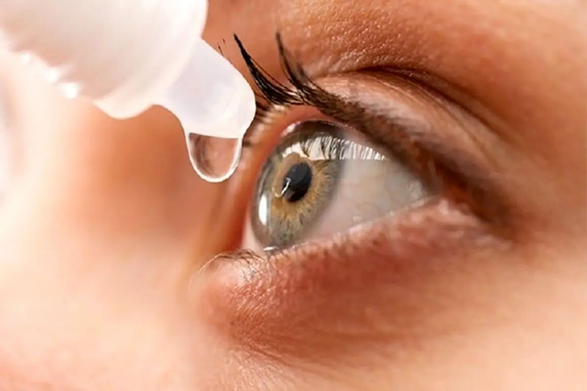 علل اصلی خشکی چشم چیست؟ + روش درمان