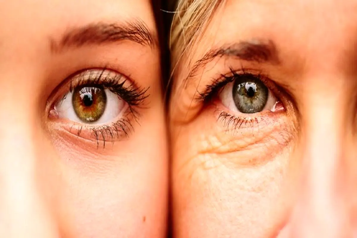 اصول مراقبت از پوست دور چشم برای جلوگیری از پیری