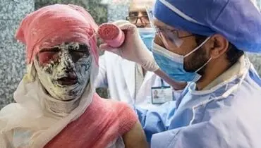 حوادث چهارشنبه‌سوری منجر به قطع دست و پا در ساوه شد