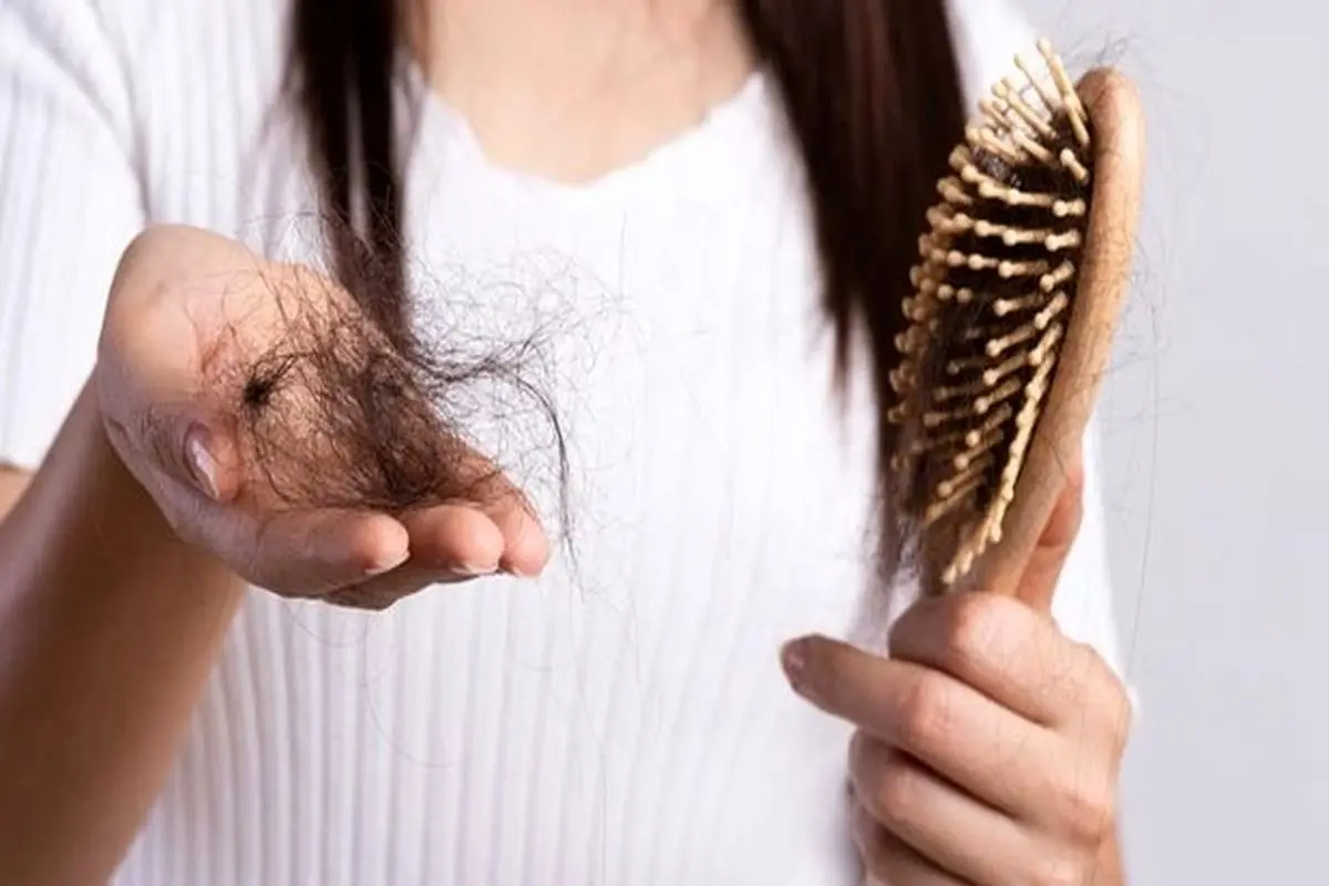 مهم‌ترین دلایل ریزش مو چیست؟ + روش درمان