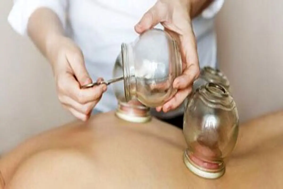 دعای حجامت امام رضا (ع)