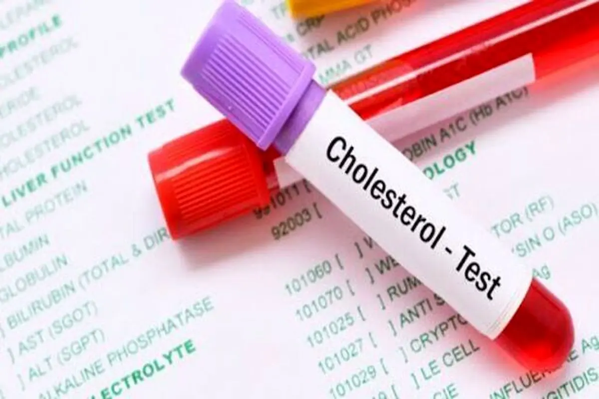 کلسترول و تری گلیسیرید چه تفاوتی باهم دارند؟