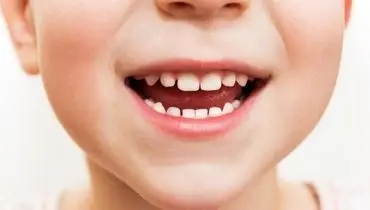نکاتی مهم در خصوص دندان‌های شیری کودکی