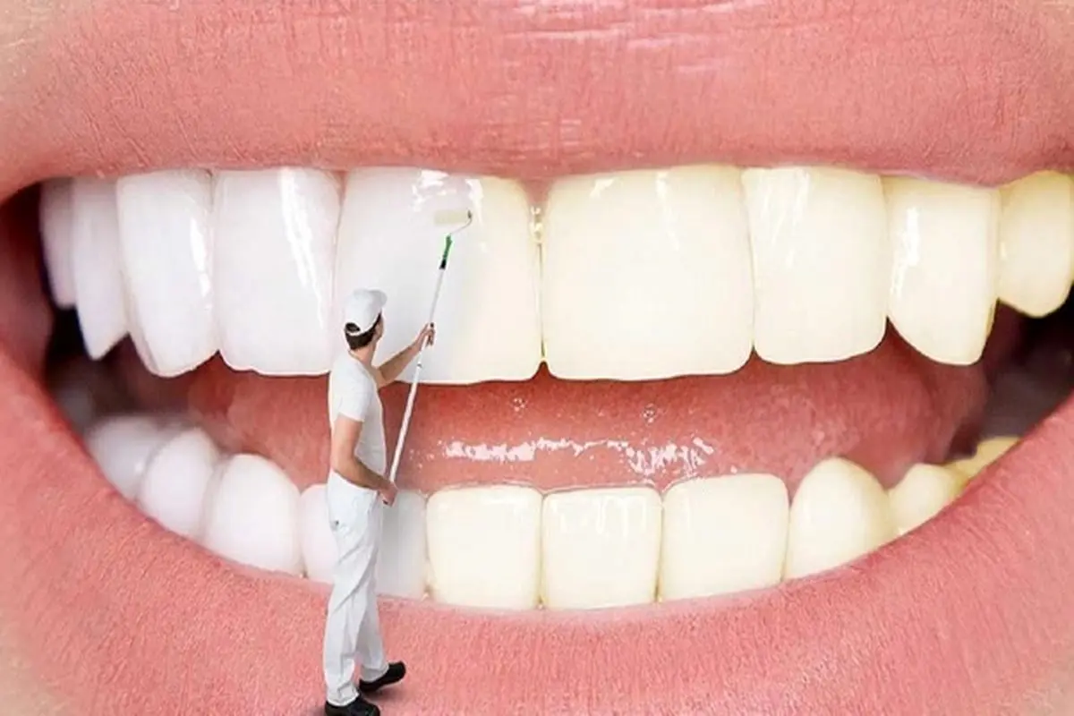 ۱۰ روش طبیعی برای داشتن دندان‌های سفید