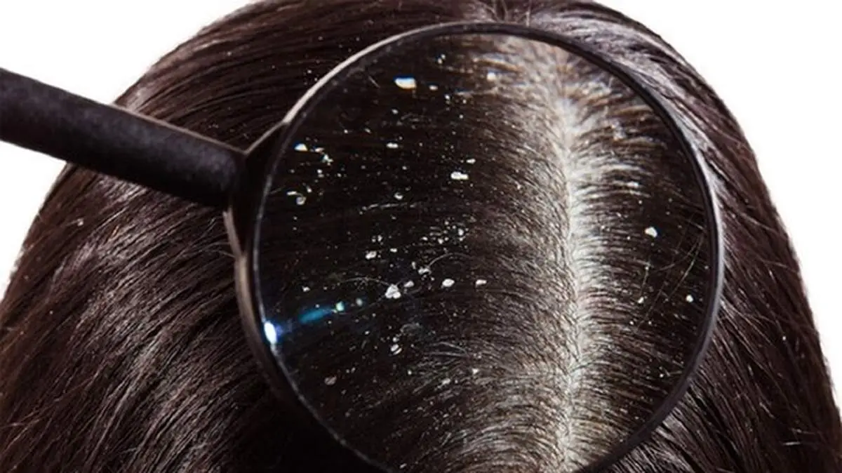 ۱۰ اشتباه رایجی که به موی شما آسیب می‌رساند+ تصاویر