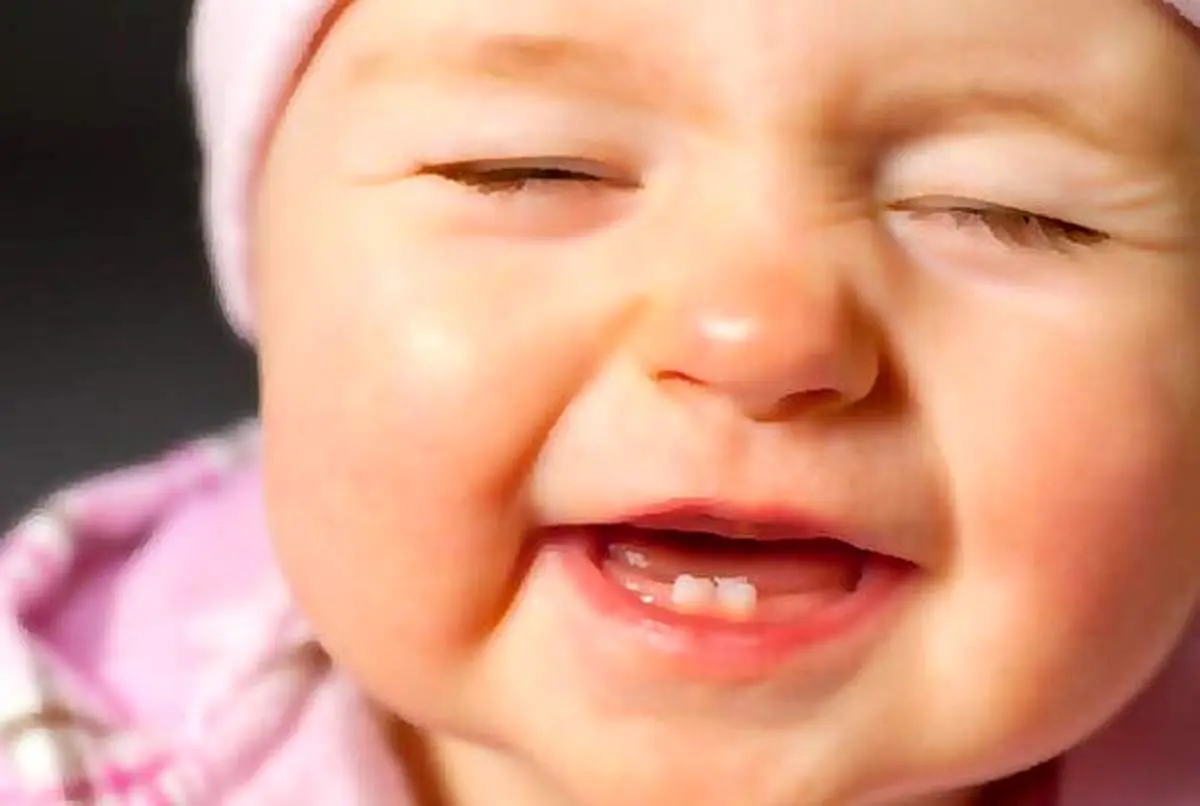 راهکارهای پیشگیری از مشکلات دهان و دندان کودکان