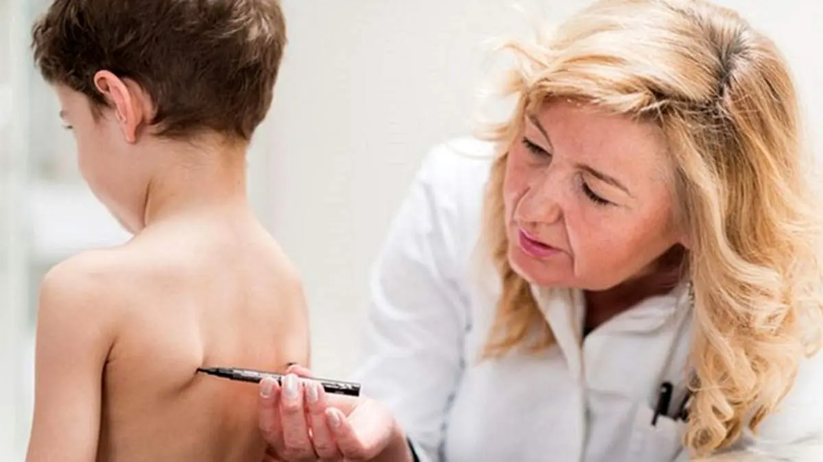 ۵ واقعیت درمورد انحراف ستون فقرات که والدین باید بدانند