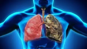 کاهش اکسیژن در ریه با وجود این نوع عارضه