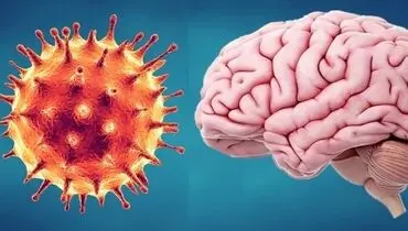 یک سوم مبتلایان به کرونا دچار اختلالات عصبی می‌شوند