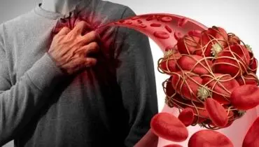 لخته شدن خون چه کسانی را تهدید می‌کند؟