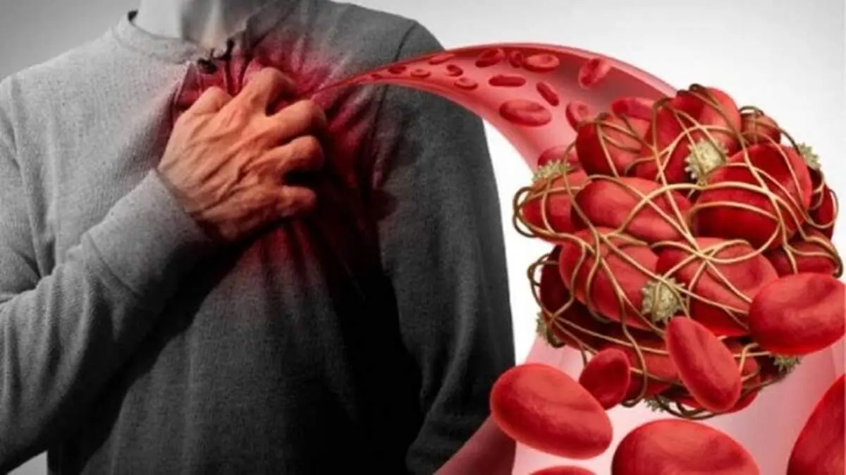 لخته شدن خون چه کسانی را تهدید می‌کند؟