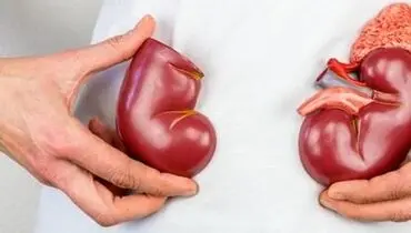 ۱۰ نشانه ای که می‌گوید شما بیماری کلیوی دارید