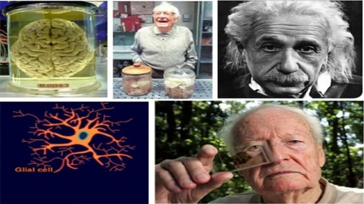 ماجرای نمونه برداری و تشریح بدون اجازه مغز اینشتین + تصاویر