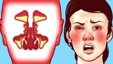 ساده‌ترین راهکار‌ها برای خلاصی از گرفتگی بینی