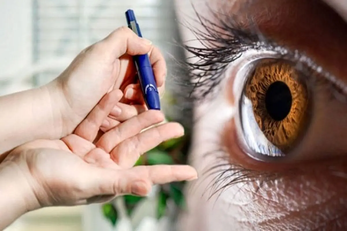 علائم تاثیر دیابت بر چشم چیست؟