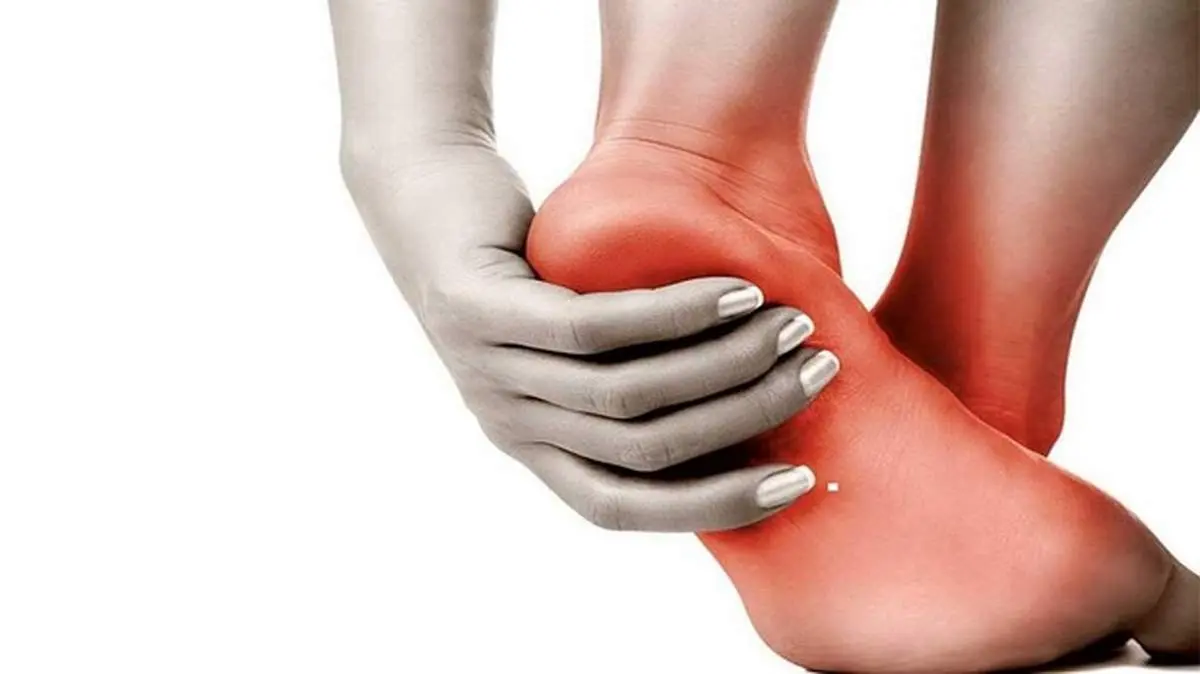 علل بروز خار پاشنه چیست و چگونه درمان می‌شود؟
