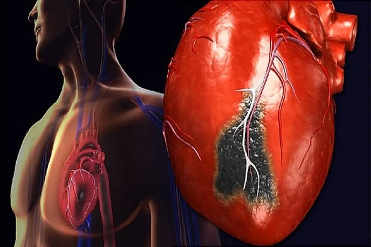 چگونه حمله قلبی را از سوء هاضمه تشخیص دهیم؟