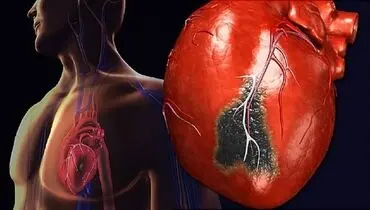 چگونه حمله قلبی را از سوء هاضمه تشخیص دهیم؟