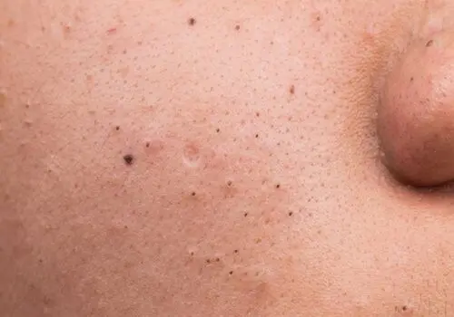 این میوه ها پوست صورت شما را شفاف، نرم و درخشان میکنند