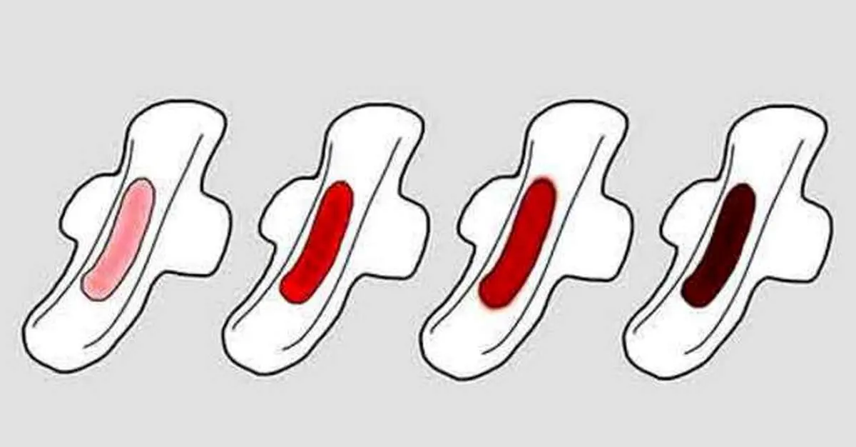 بررسی علل کم شدن خونریزی قاعدگی