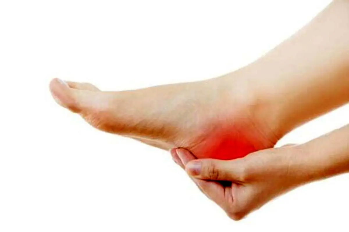 بیماری دردناکی که پاشنه و پنجه‌ پا را نشانه می‌گیرد