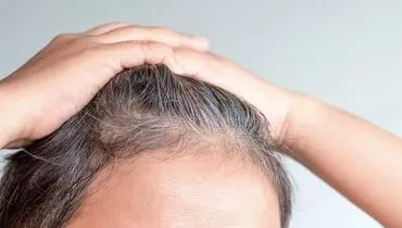چگونه از سفید شدن موها جلوگیری کنیم؟
