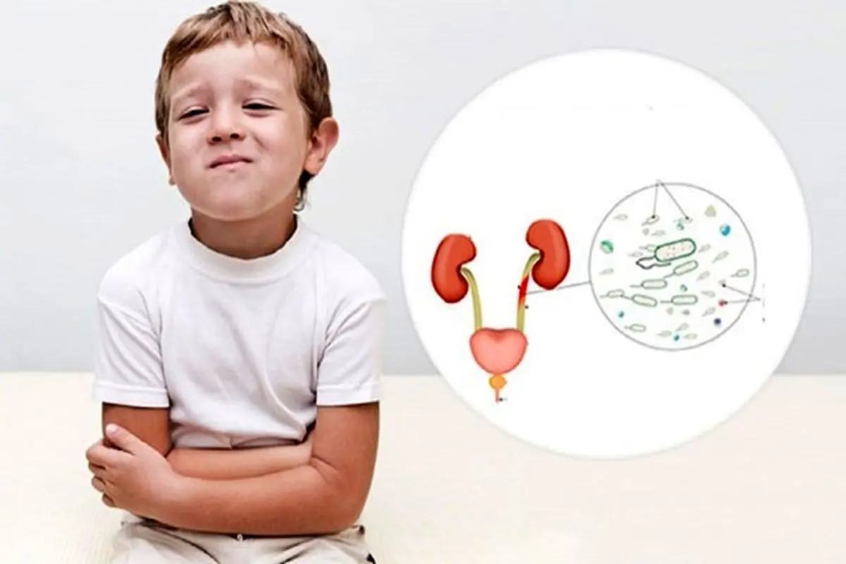 عامل اصلی افزایش فشار خون ثانویه در کودکان چیست؟