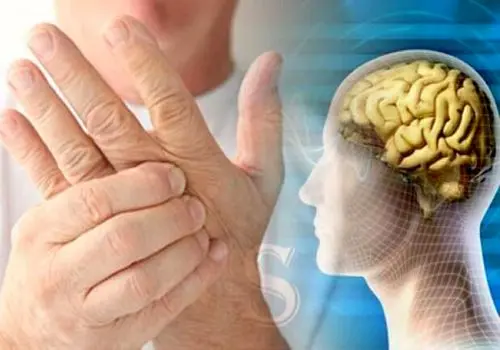 از این علائم ساده هشداردهنده ام اس غافل نشوید