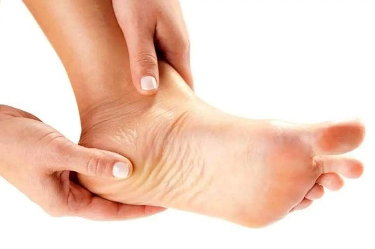 علت و علائم خارپاشنه چیست؟ + درمان خارپاشنه با طب سنتی