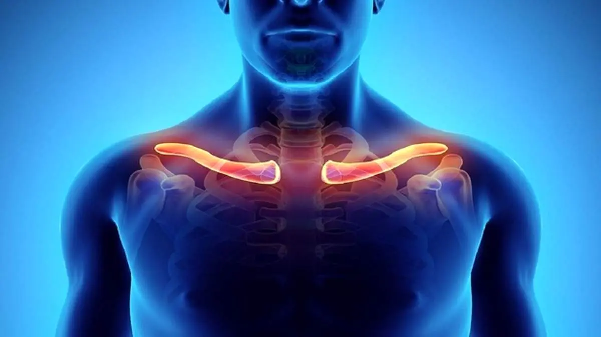 شکستگی ترقوه را چگونه درمان کنیم؟