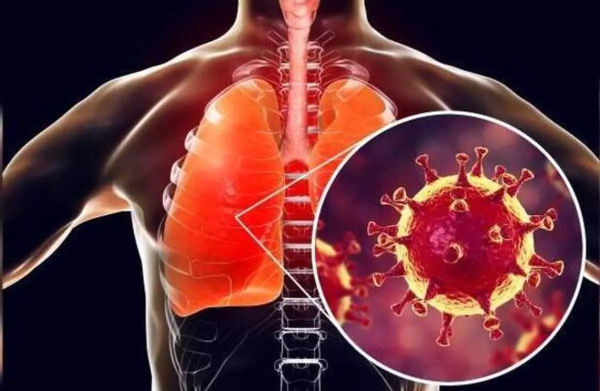 چطور نگذاریم ریه‌های‌مان محله کرونا نشود؟ + اینفوگرافی