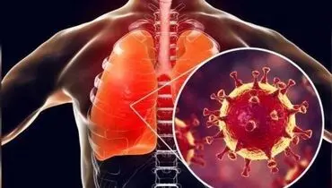 چطور نگذاریم ریه‌های‌مان محله کرونا نشود؟ + اینفوگرافی