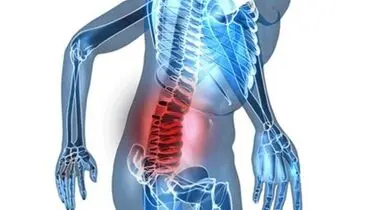 از زنجبیل تا زردچوبه؛ درمان دردها بدون نیاز به داروی مسکن