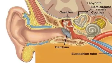 سندرمی که شما را ناشنوا می‌کند