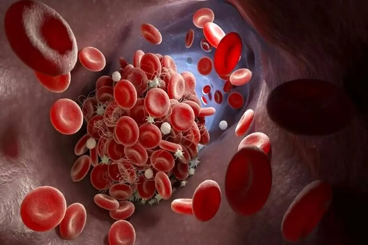 شناسایی پروتئین مهمی که از لخته شدن خون کشنده پیشگیری می‌کند