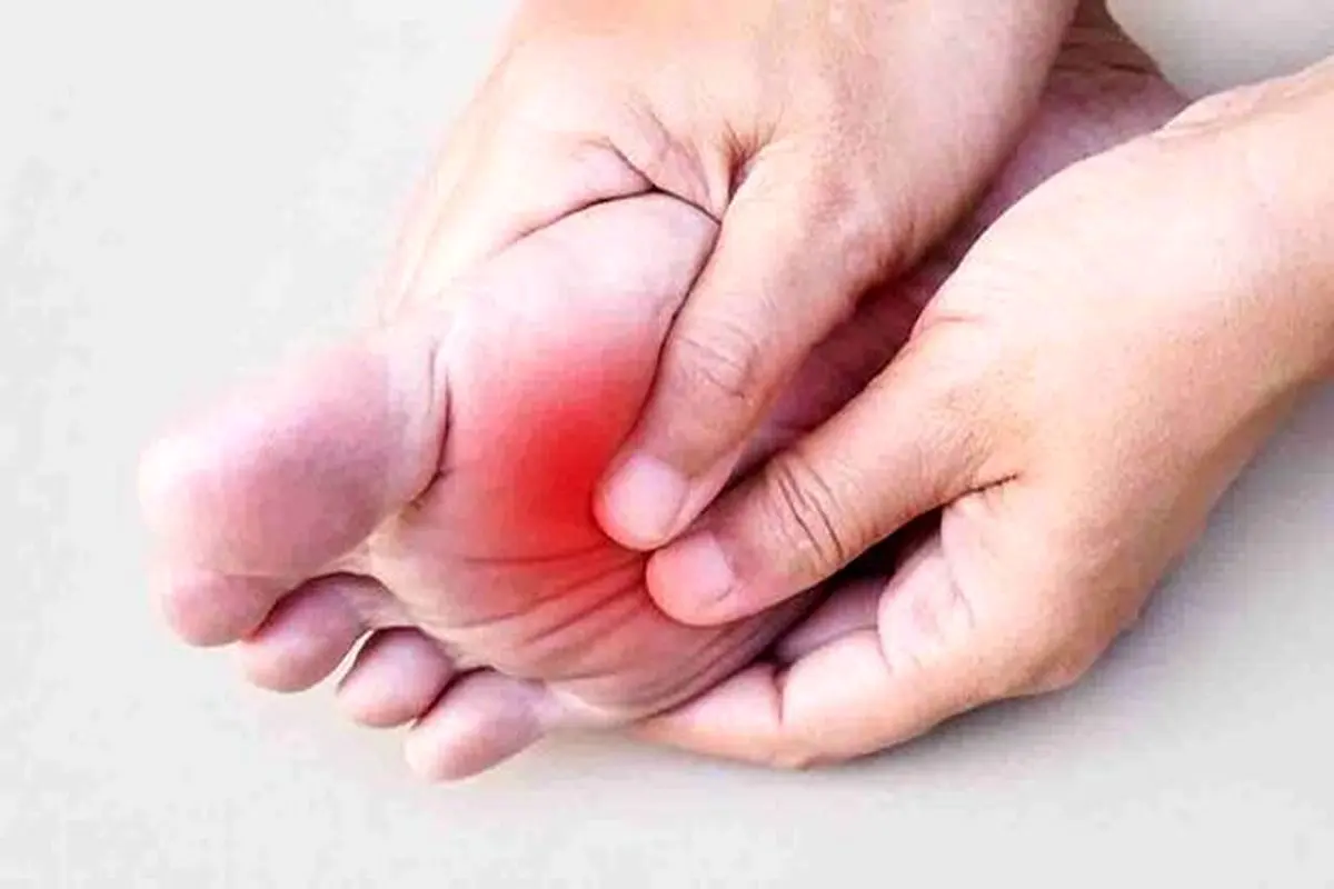 علت داغ شدن کف پا چیست؟ + درمان های خانگی
