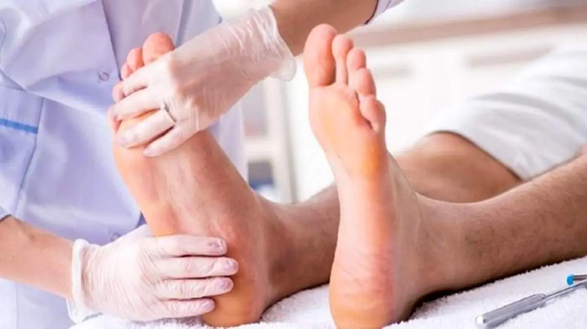 راهکار‌های کنترل و پیشگیری از نقرس