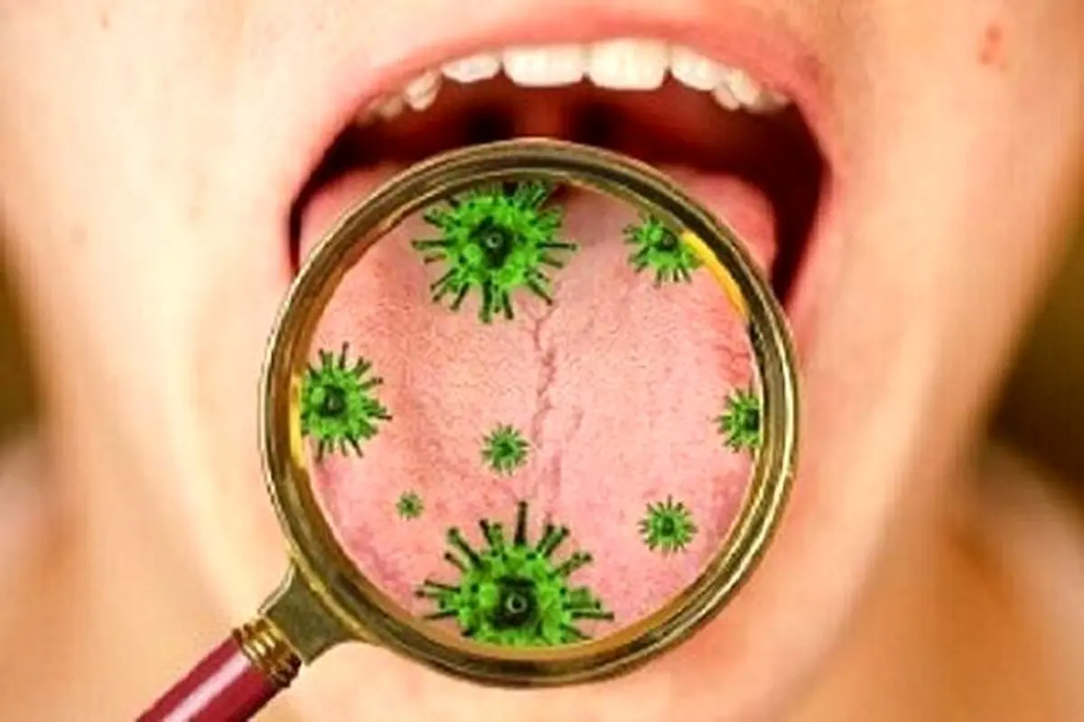 یافته های جدید در خصوص تکثیر کروناویروس در غدد بزاق دهان