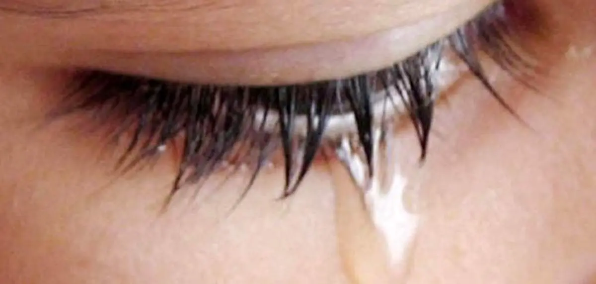 بیماری مرگباری که اشک خونین نشانه آن است