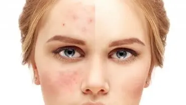 ساده‌ترین مواد موجود در آشپزخانه برای شادابی پوست