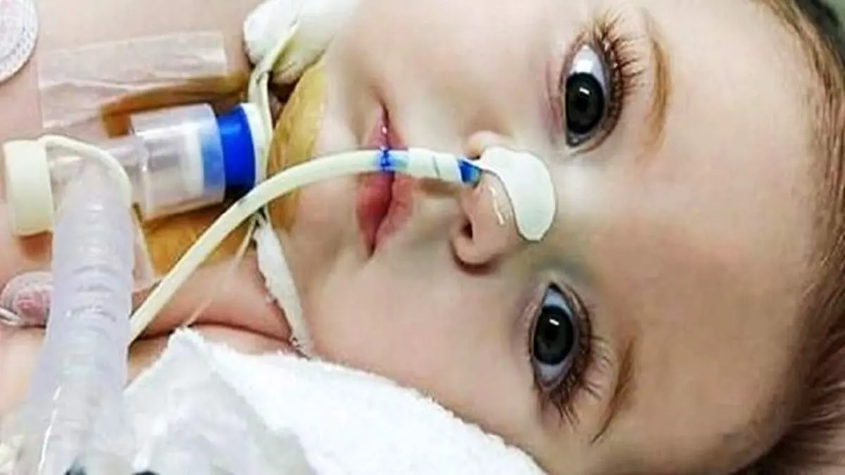 بیماری که با ریه های کودکان سر جنگ دارد