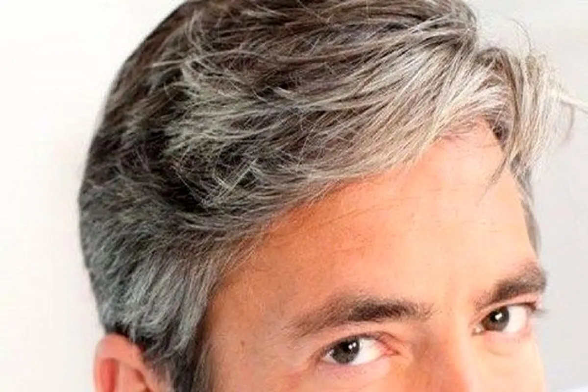 عوامل سفیدی زودرس مو‌ها را بشناسید