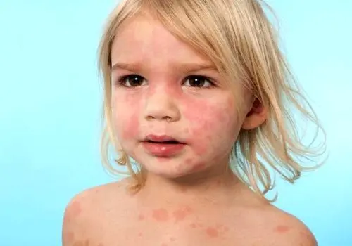 پوست شما چه رازی از سلامت‌تان فاش می‌کند؟ علائمی که می‌توانند خطرناک باشند