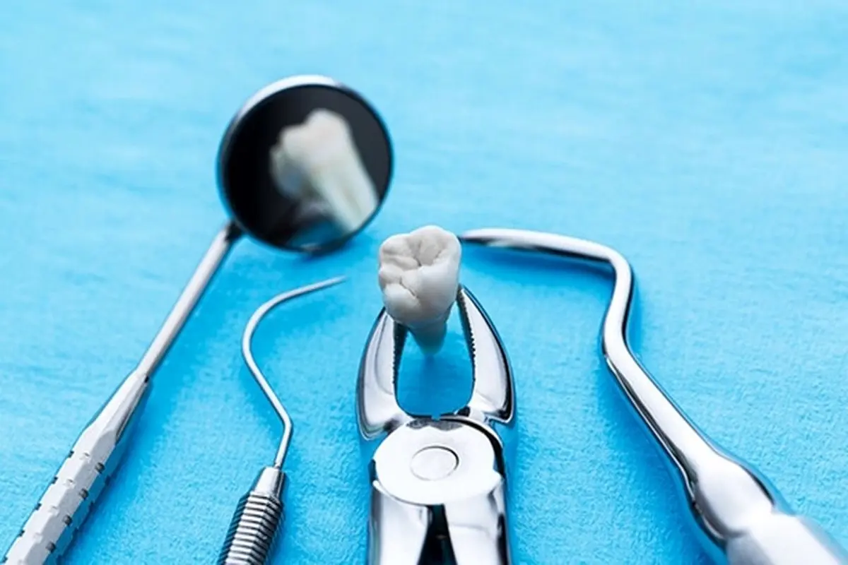 آیا کشیدن دندان عقل بر بهتر شدن حس چشایی موثر است؟